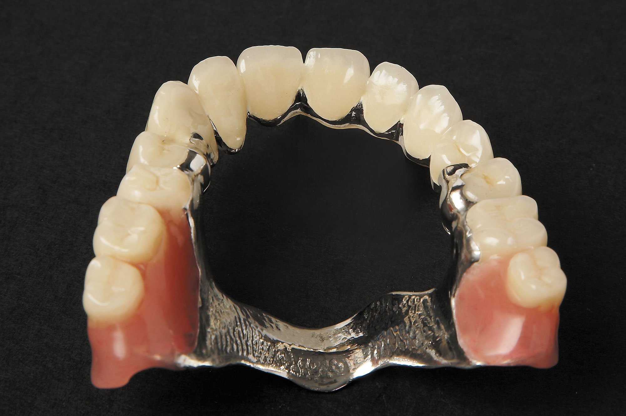 full chrome denture