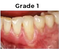 Grade1