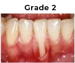 Grade2