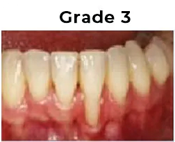 Grade3