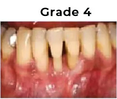 Grade4