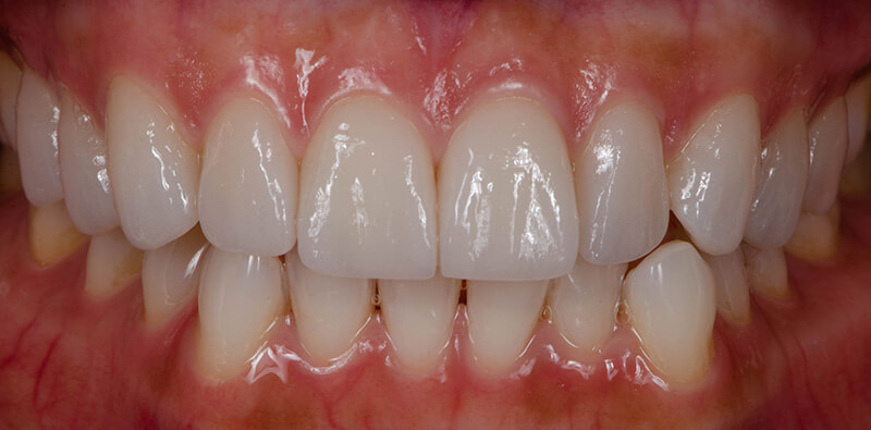 Healthy gums