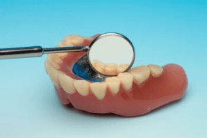 dental implant treatment bulimba