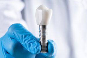 bali dental implant types balmoral
