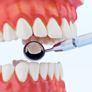 dental implant surgery bulimba