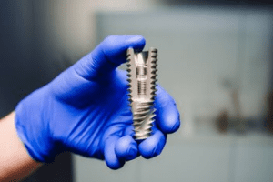 dental implant treatment bulimba