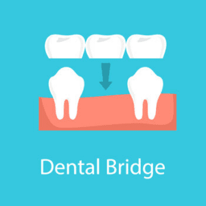 Dental implant procedure if you're missing one or more teeth bulimba