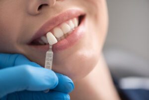 dental-implants-cost-india-crown-colour-bulimba