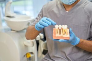Dental Implants Philippines posts balmoral