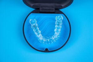 Invisalign Vs Braces orthodontic aligners balmoral