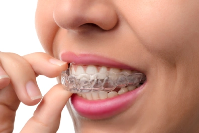 Invisalign and Lifestyle Adaptation