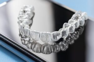 result after invisalign balmoral