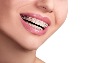 specialist orthodontists