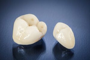 tooth cap vs crown shell
