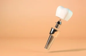 dental implant components parts dental implant components parts