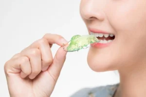 patient about to a dental retainer patient about to a dental retainer