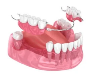 do partial dentures need to be removed at night partial do partial dentures need to be removed at night partial