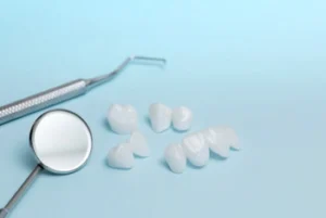 Dental Bonding Procedure veneers Dental Bonding Procedure veneers