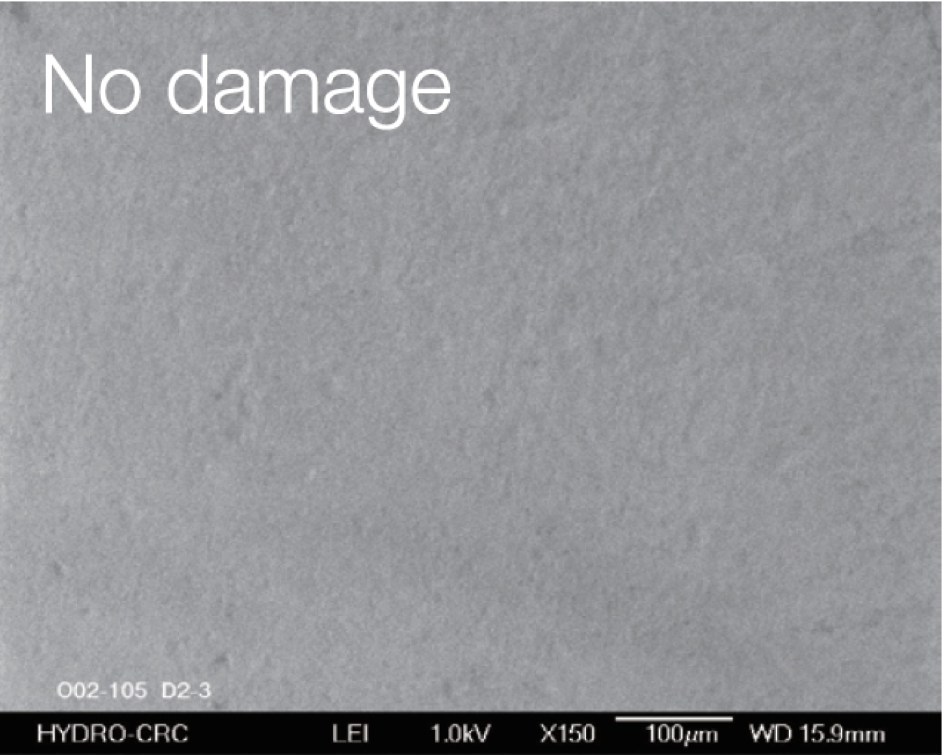 Enamel Damage Enamel Damage