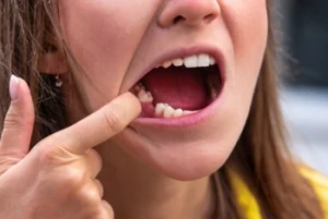 opting for tooth extraction opting for tooth extraction